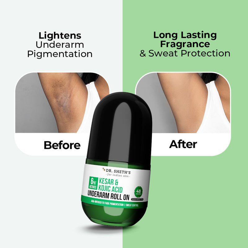 Kesar & Kojic Acid Underarm Roll On - 50ml