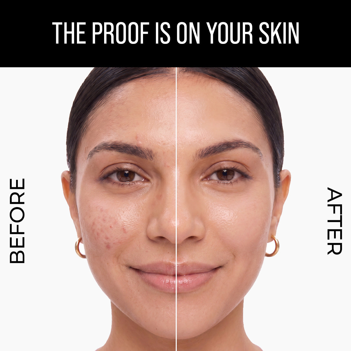 Lipo-Gluta & Alpha Arbutin Pigmentation Serum - 30ml