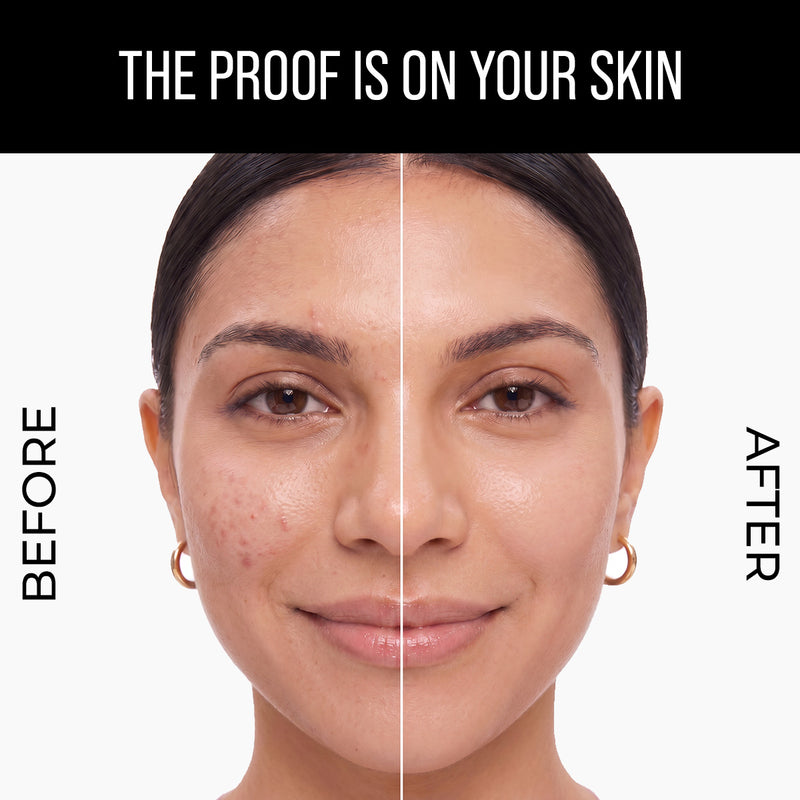 Lipo-Gluta & Alpha Arbutin Pigmentation Serum - 30ml
