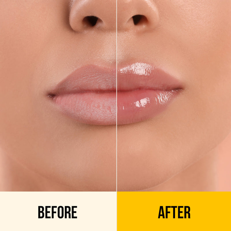 Ceramide & Vitamin C Lip Balm - 10g
