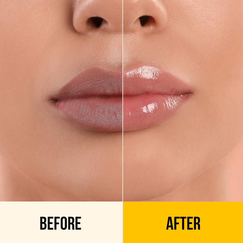 Kesar & Kojic Acid Lip Balm - 10g